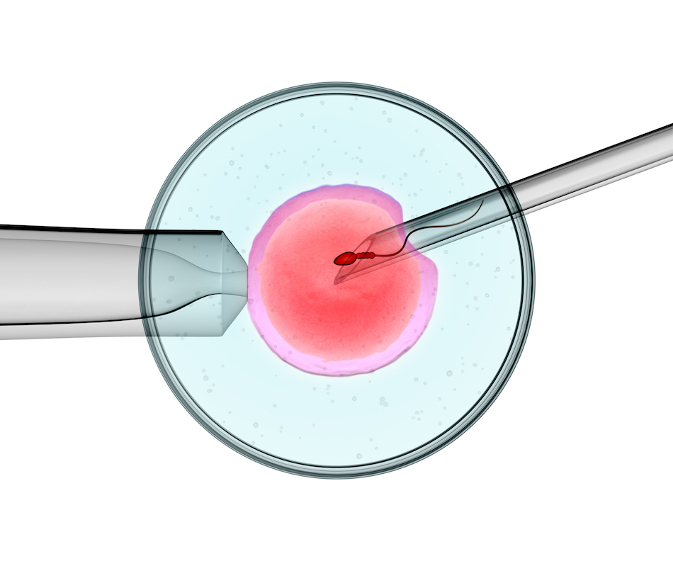 Explorer les traitements de fertilité : De la FIV à l'ICSI – Ce que vous devez savoir